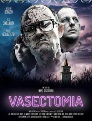 Vasectomia